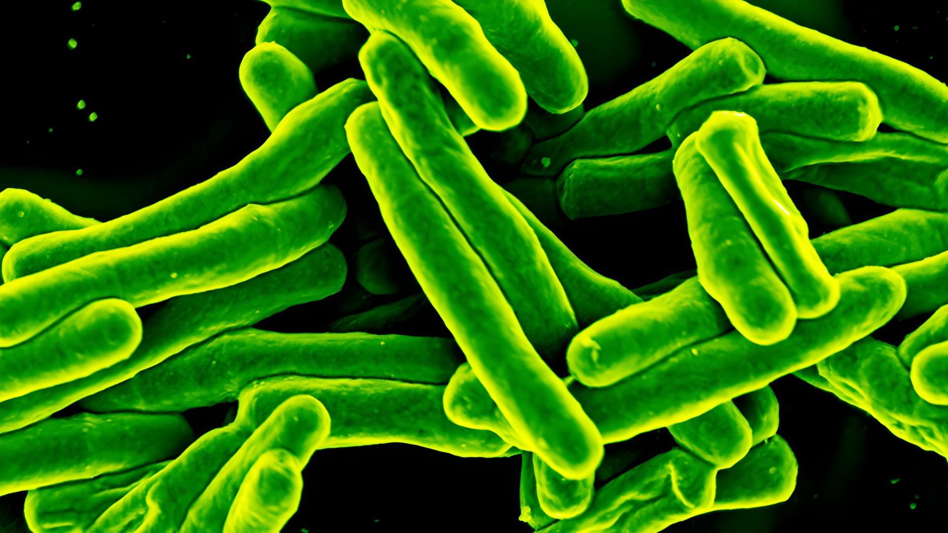 Rasterelektronenmikroskopische Aufnahme des Bakteriums Mycobacterium tuberculosis, das Tuberkulose verursacht. 