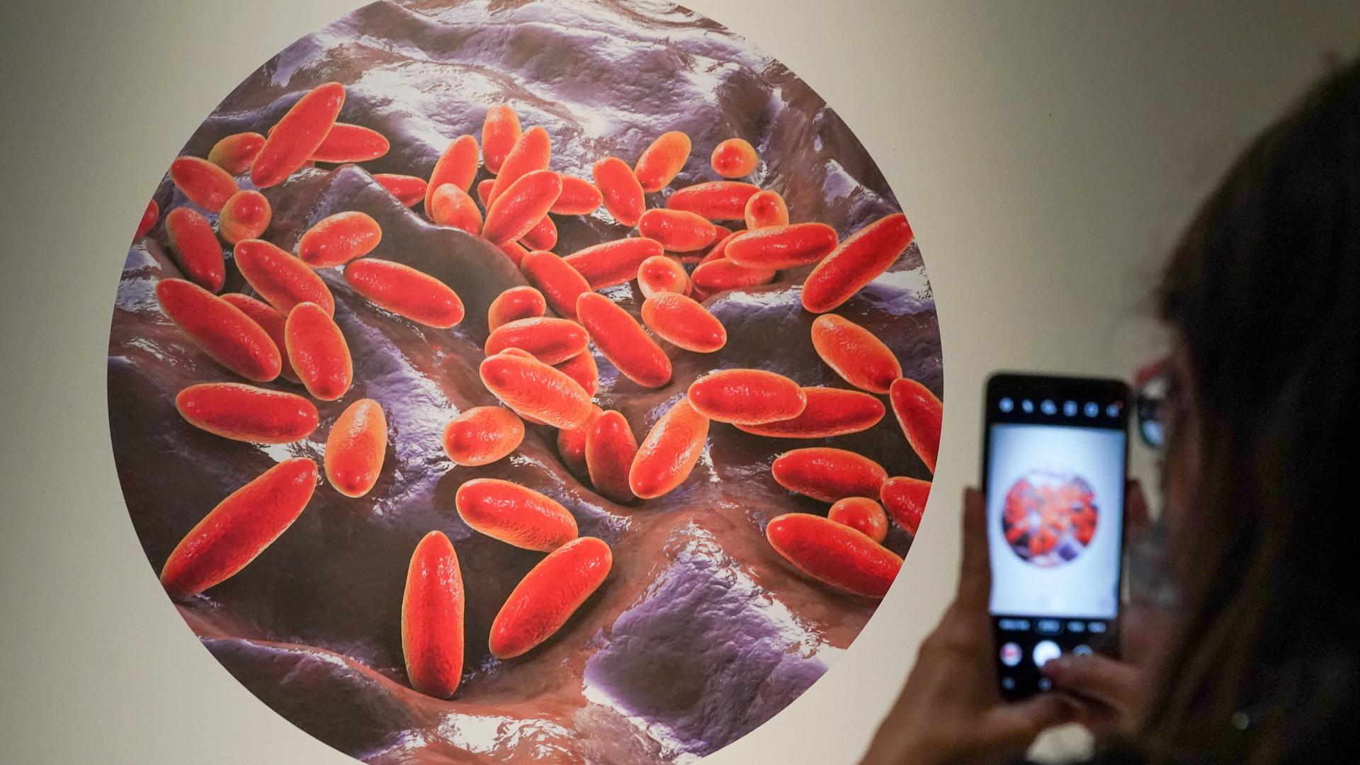 Die Abbildung des für die Beulen- und Lungenpest verantwortlichen Bakteriums Yersinia pestis 