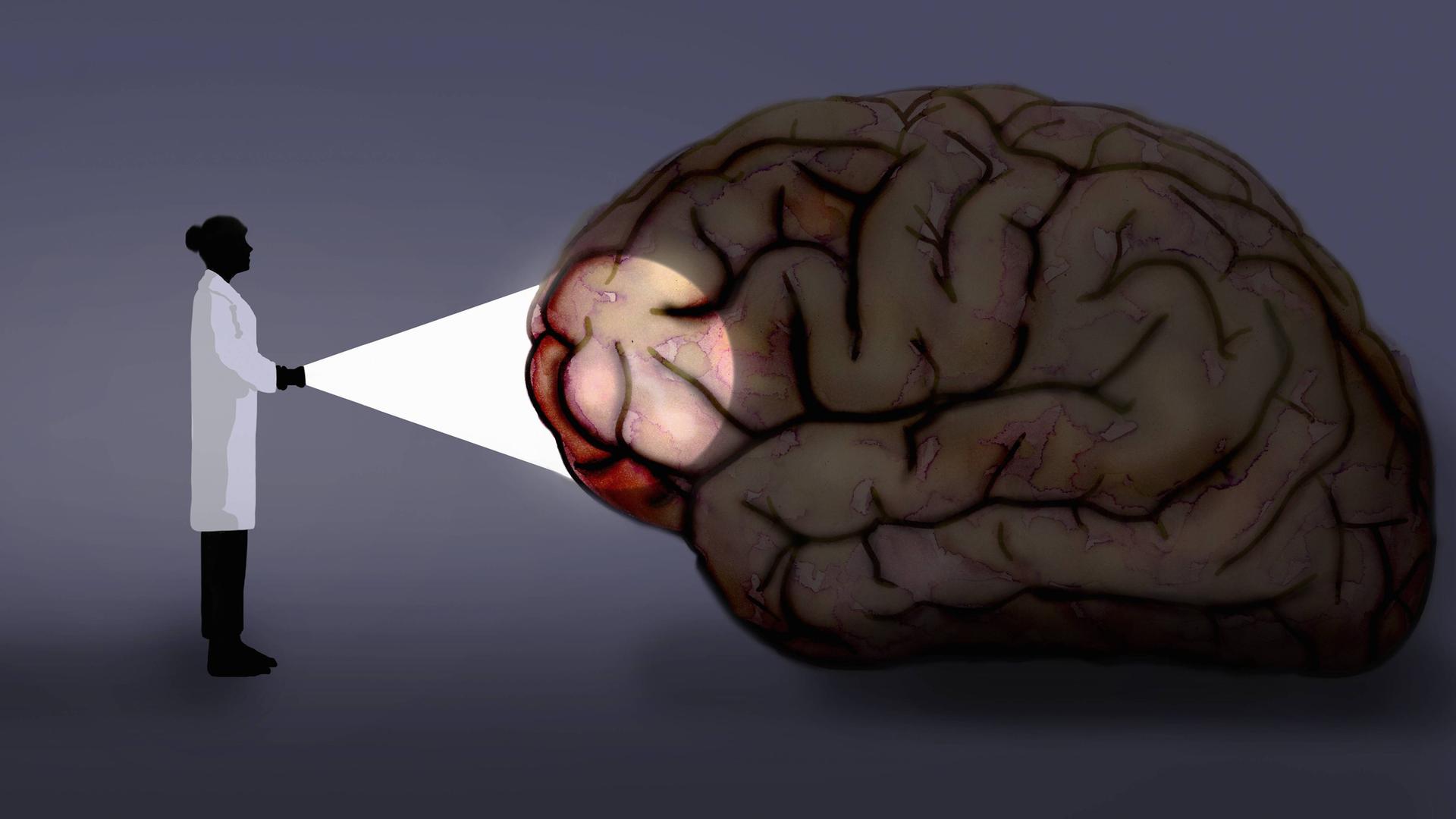 Wissenschaftlerin strahlt mit einer Taschenlampe auf ein menschliches Gehirn 