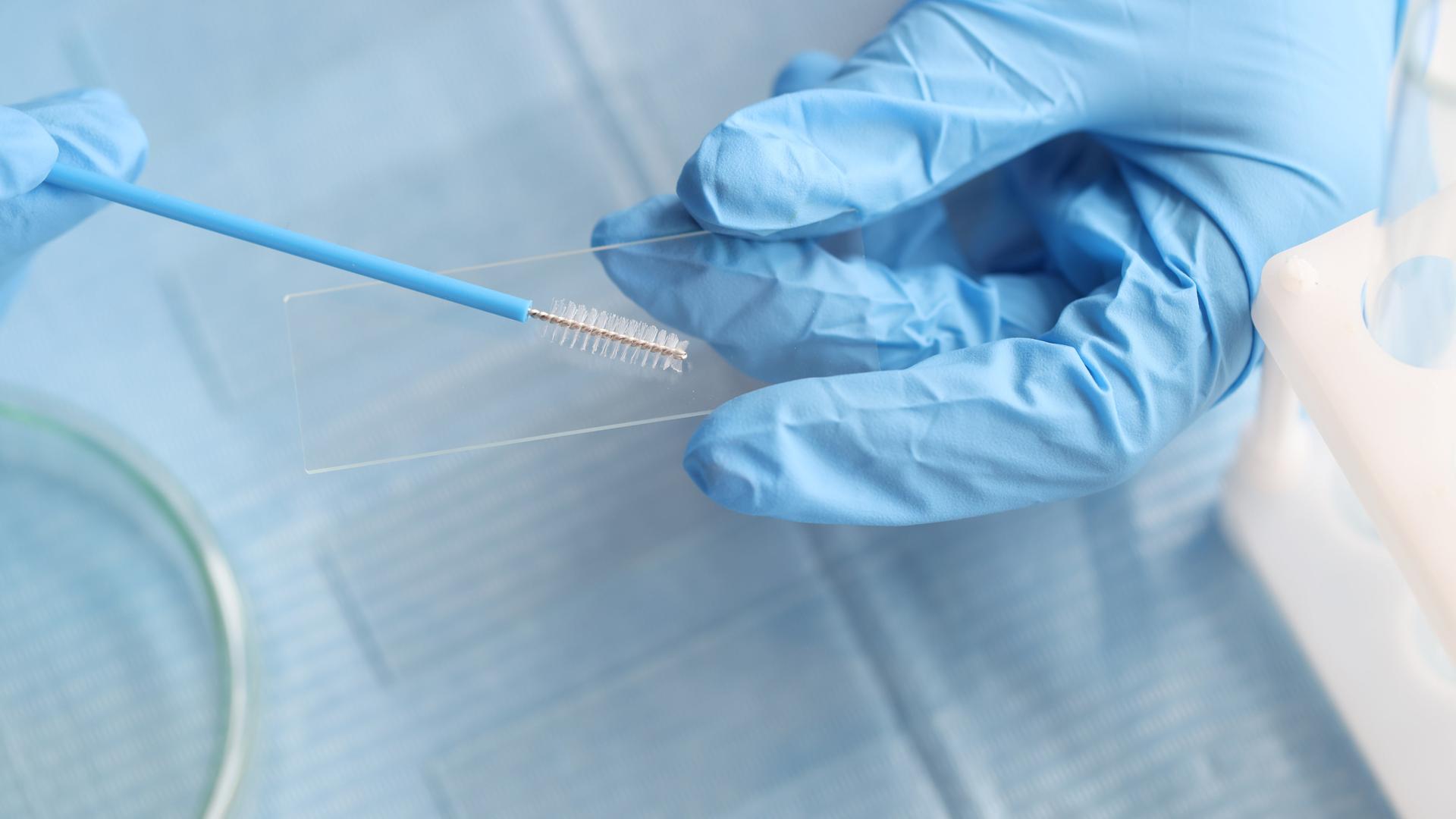 Eine Person trägt blaue Handschuhe und hält einen Abstrich