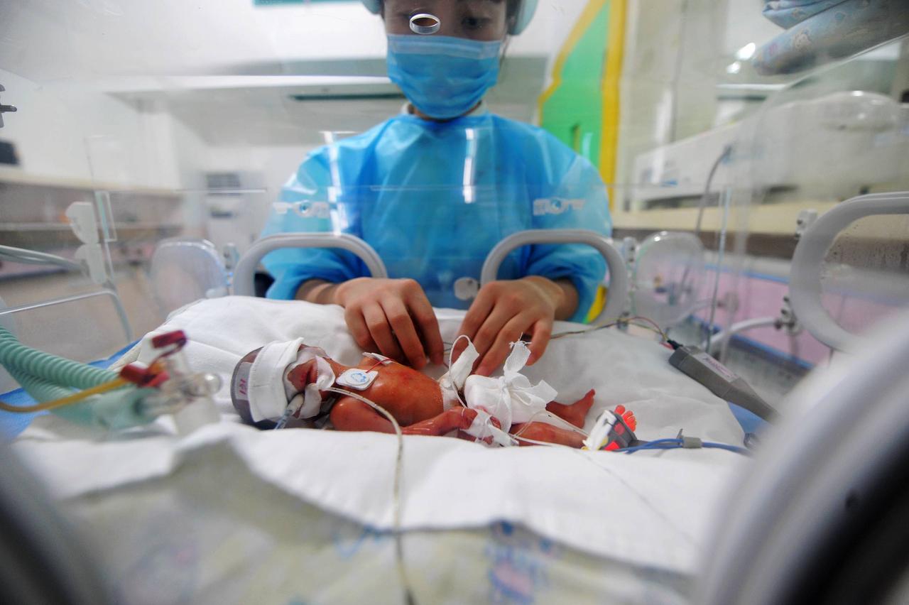 Ein Frühchen in einem Inkubator im Hunan Children's Hospital in Changsha, China