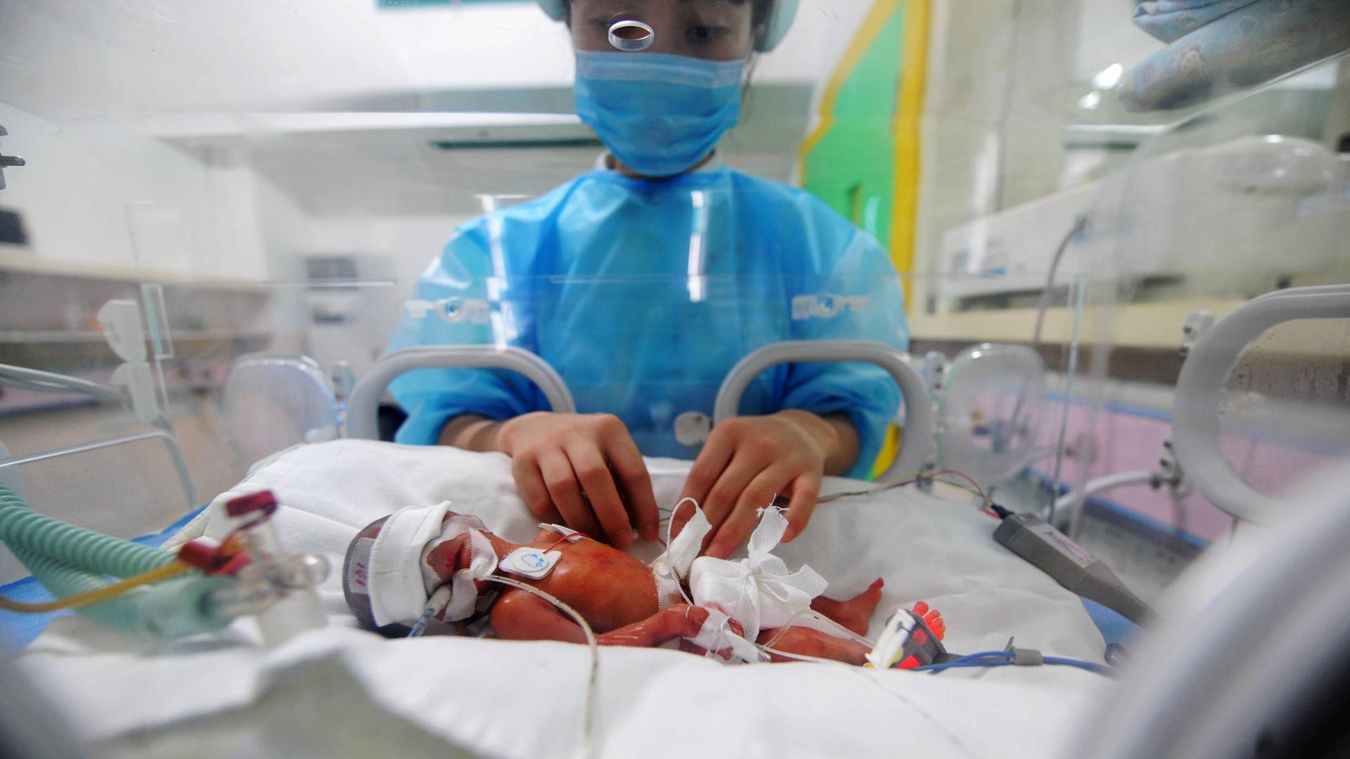 Ein Frühchen in einem Inkubator im Hunan Children's Hospital in Changsha, China Ein Frühchen in einem Inkubator im Hunan Children's Hospital in Changsha, China