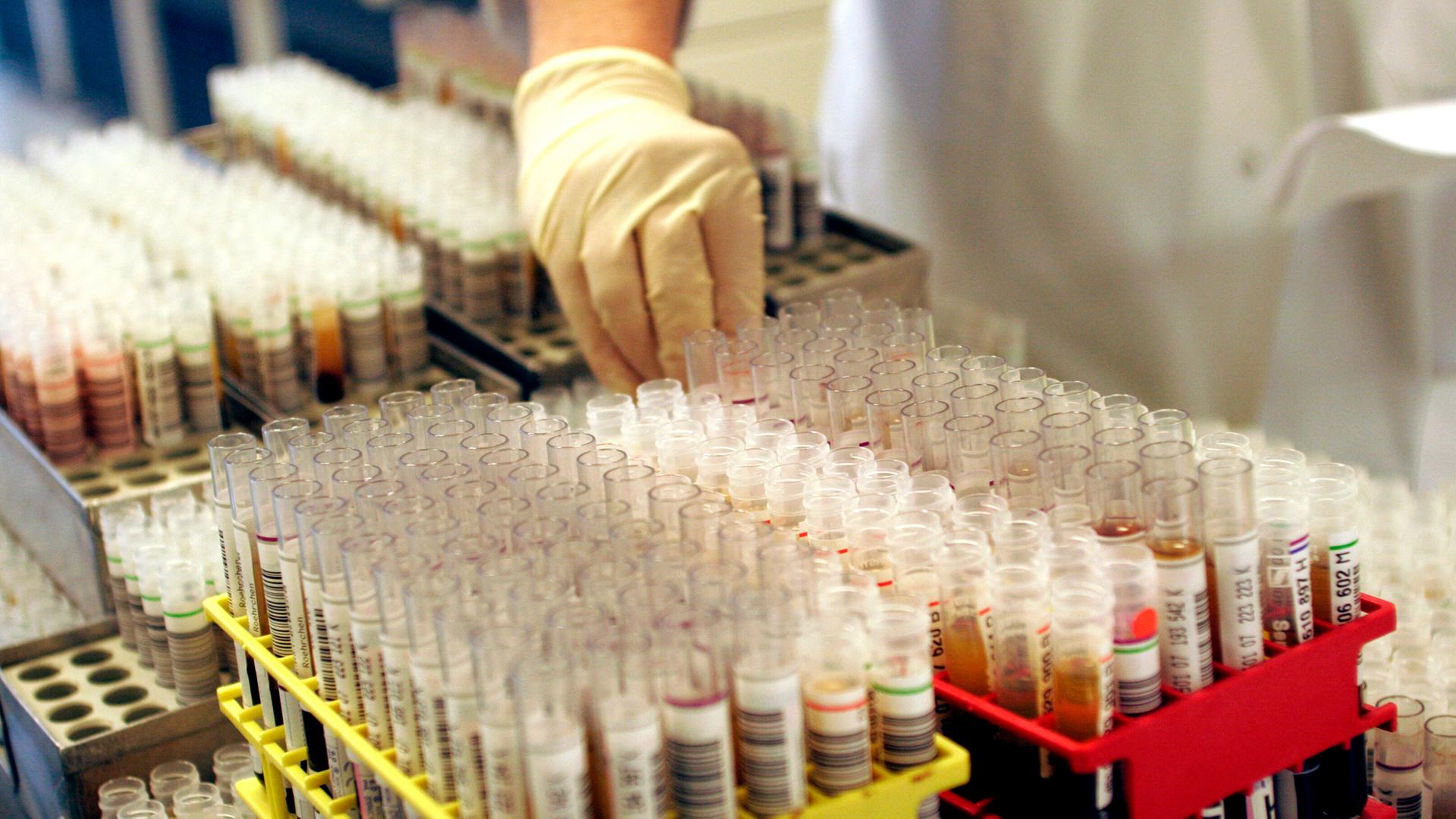 Auf einem Labortisch stehen mit Blut gefüllte Analyseröhrchen zur Untersuchung auf ansteckende Krankheiten wie HIV und Syphilis.