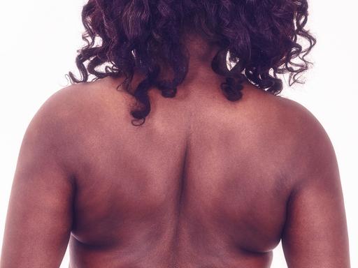 Rücken einer dunkelhäutigen Frau.