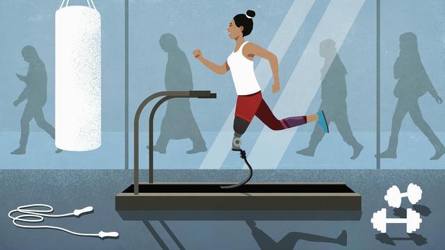 Illustration: Eine Frau mit Beinprothese beim Joggen auf dem Laufband im Fitnessstudio.