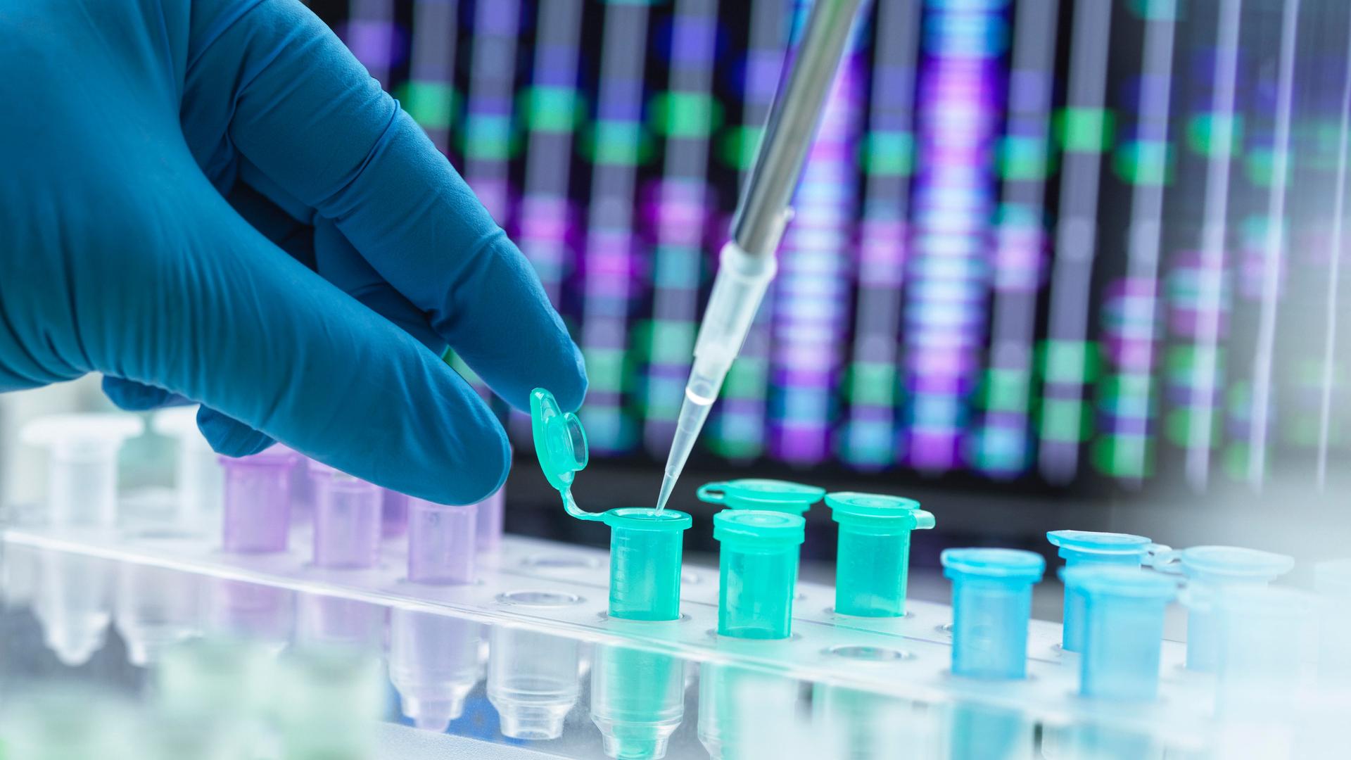 Ein Wissenschaftler mit Handschuh füllt ein DNA-Sample mit einer Pipette in ein Teströhrchen. (Symbolbild) Ein Wissenschaftler mit Handschuh füllt ein DNA-Sample mit einer Pipette in ein Teströhrchen. (Symbolbild)