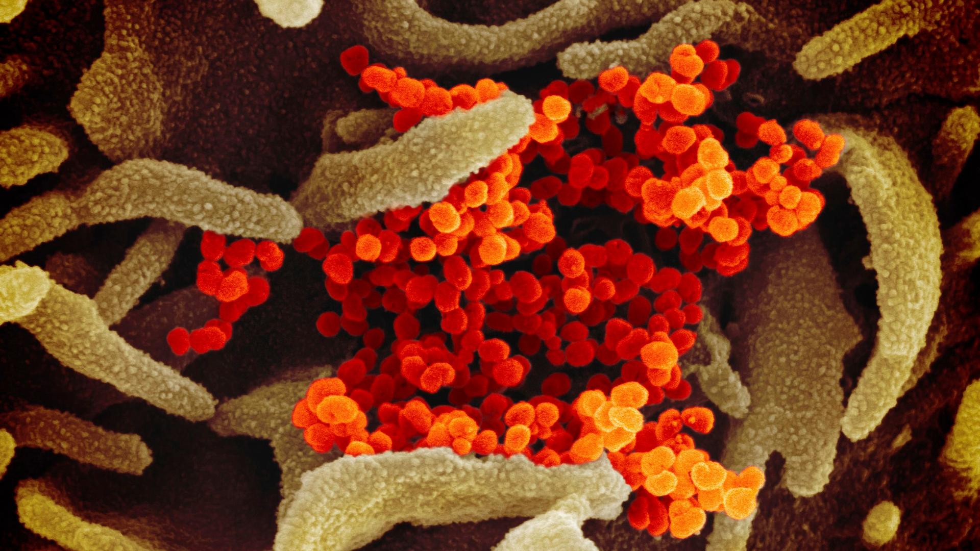 USA, Hamilton: Eine elektronenmikroskopische Aufnahme des «U.S. National Institute of Health» zeigt das neuartige Coronavirus (SARS-CoV-2) (orange), das aus der Oberfläche von im Labor kultivierten Zellen (grau) austritt. Die Probe wurde von einem Patienten in den USA isoliert.