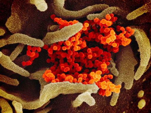 USA, Hamilton: Eine elektronenmikroskopische Aufnahme des «U.S. National Institute of Health» zeigt das neuartige Coronavirus (SARS-CoV-2) (orange), das aus der Oberfläche von im Labor kultivierten Zellen (grau) austritt. Die Probe wurde von einem Patienten in den USA isoliert.