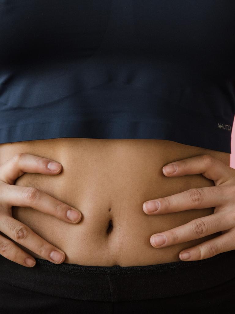 Eine Frau stemmt die Hände an den Bauch