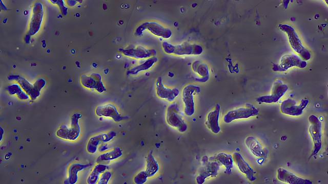 Naegleria fowleri unter dem Mikroskop: Sieht aus wie lange Würmer.