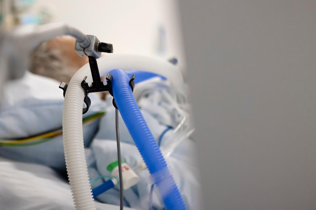 Schläuche eines Beatmungsgeräts sind an einem Bett in einem der Behandlungszimmer der Intensivstation am Universitätsklinikum in Kiel befestigt. Man sieht einen Kopf auf einem Kissen liegen. 