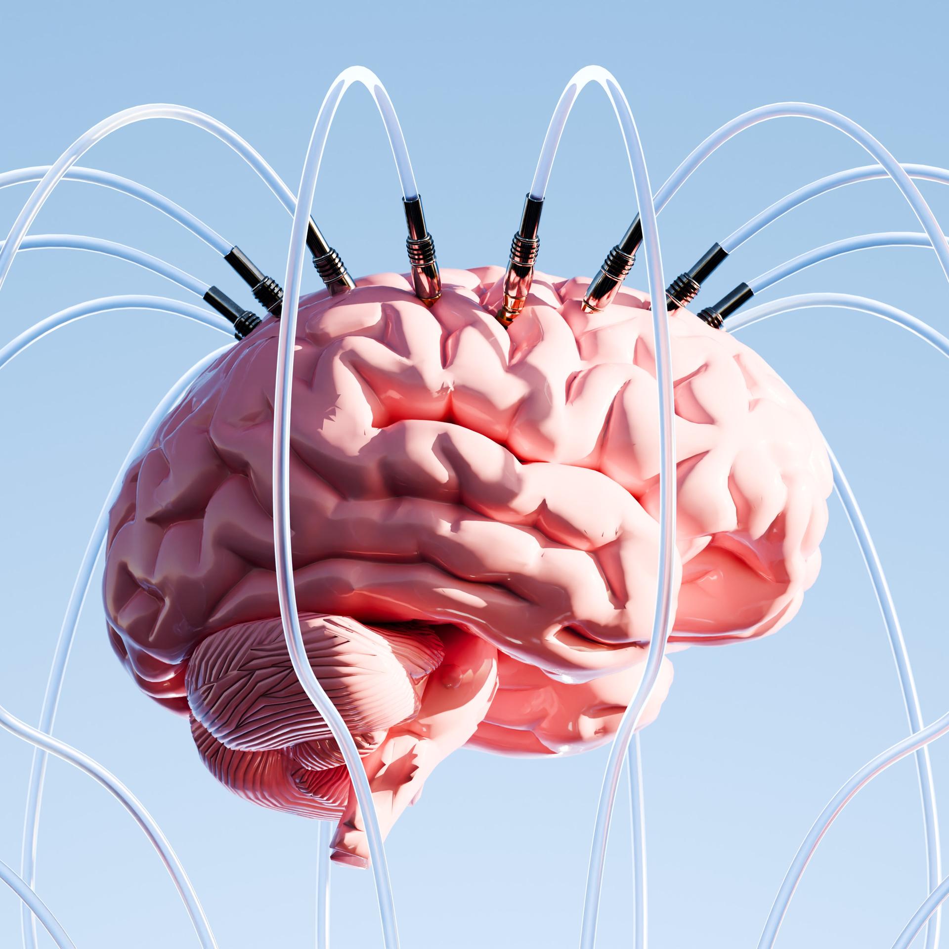 Mind Writer (1/2) - Hirnschrittmacher für die kranke Psyche