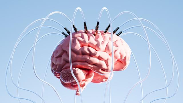 Ein futuristisches, surreales Bild zeigt ein Gehirn, das frei in der Luft schwebt und kunstvoll mit zahlreichen Drähten verbunden ist.