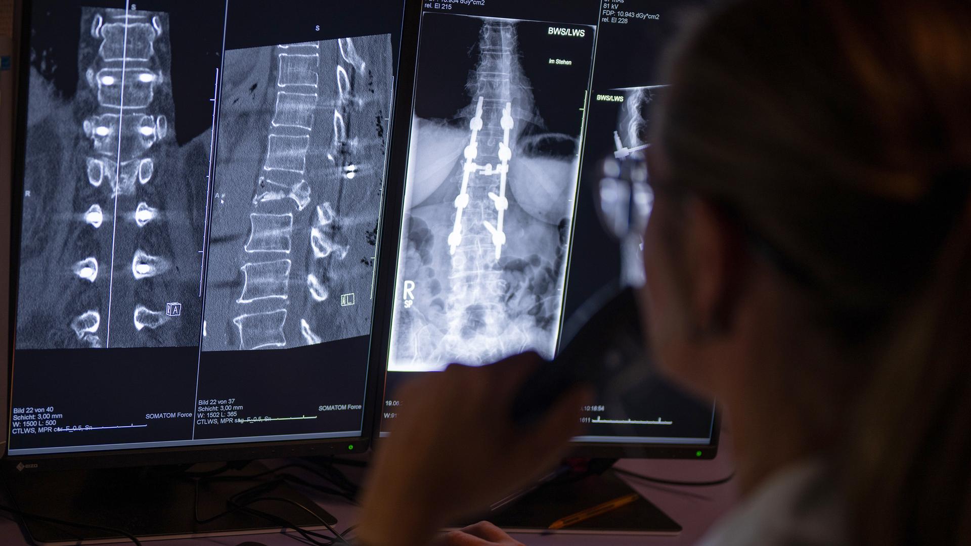Eine Radiologin sitzt an einem Rechner und wertet Aufnahmen eines Patienten aus.