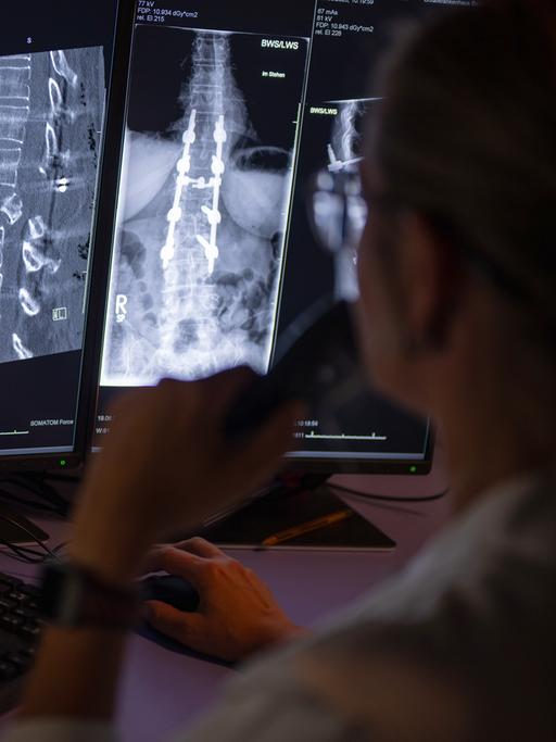 Eine Radiologin sitzt an einem Rechner und wertet Aufnahmen eines Patienten aus.