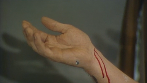 Blut läuft einen Arm hinunter. Blut läuft einen Arm hinunter.