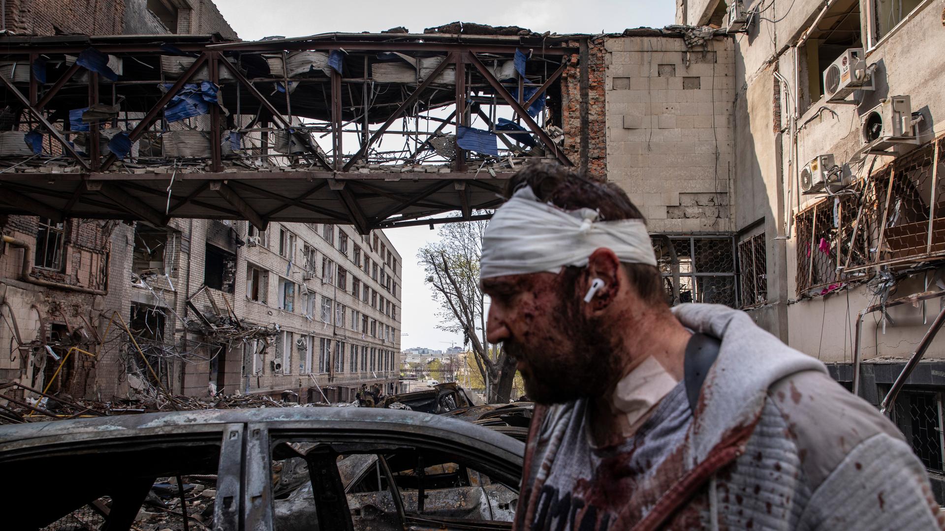 Verletzungen und Zerstörungen nach einem russischen Artillerieangriff im ukrainischen Charkiw.