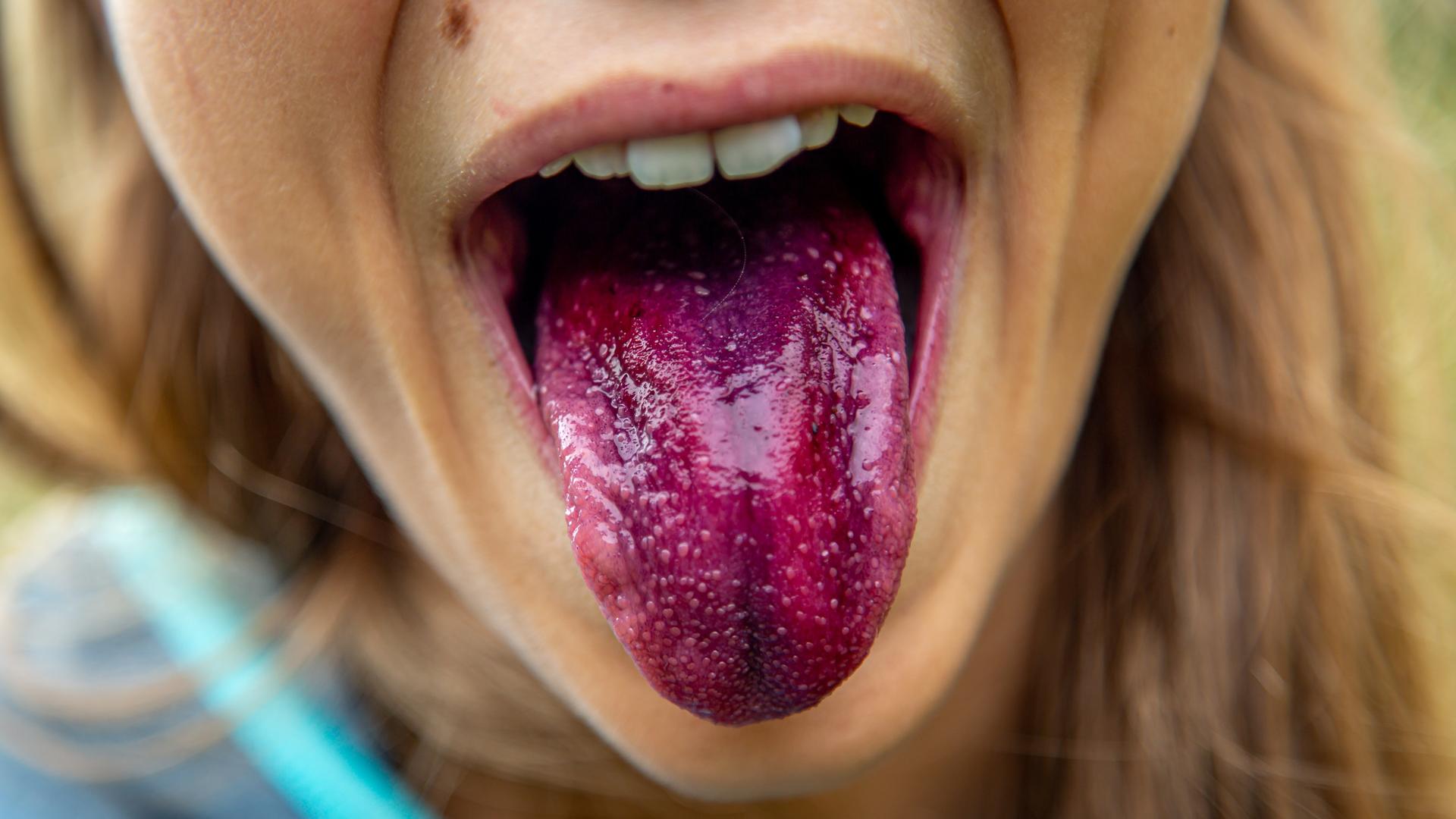 Ein Kind streckt seine lila eingefärbte Zunge heraus.