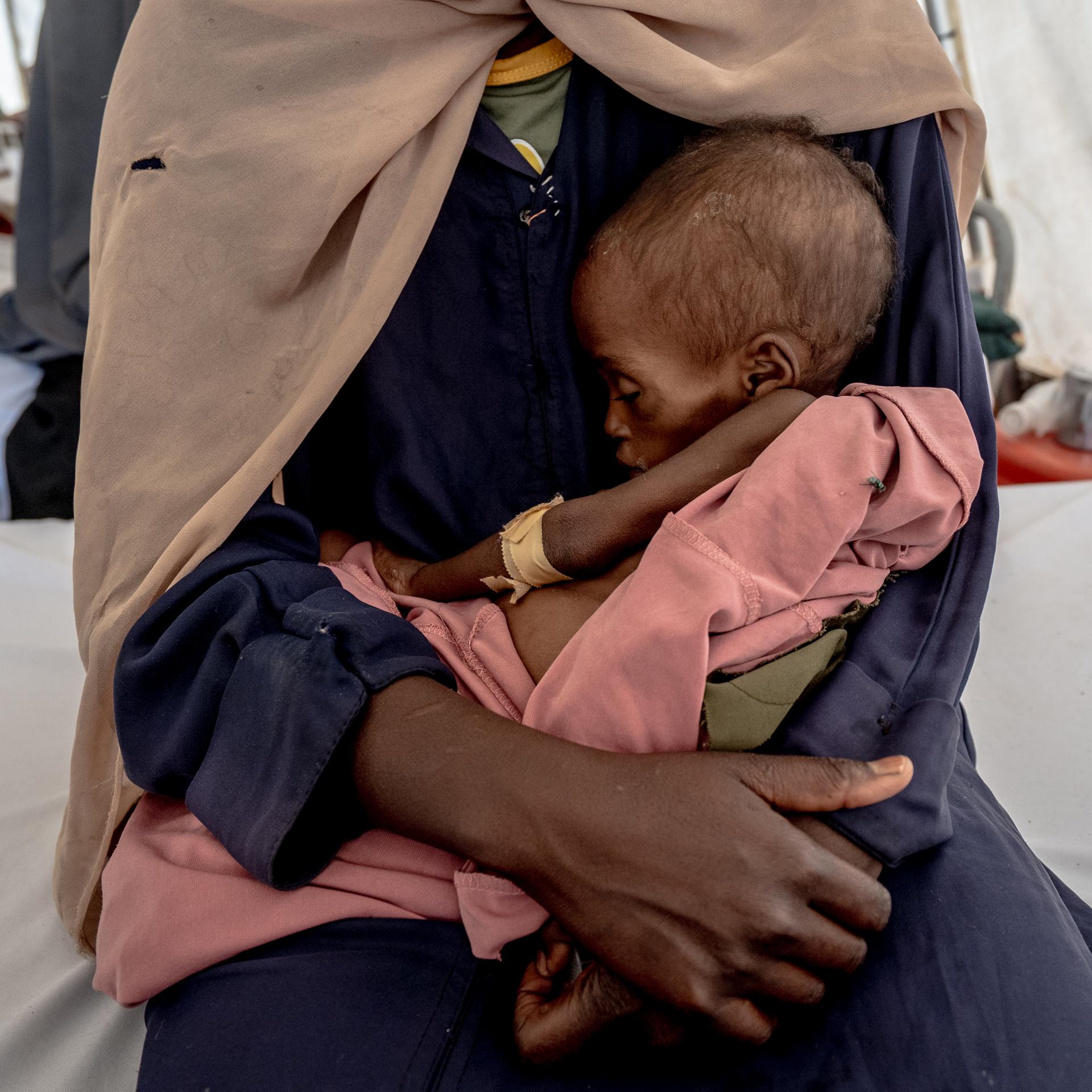 Ein dreijähriges Kind das 5,3 Kilogramm wiegt liegt in den Armen der Mutter auf einer Station für unterernährte Kinder im „Paris-Krankenhaus“ von Ärzte ohne Grenzen in Tawila in einem Flüchtlingslager im Sudan.