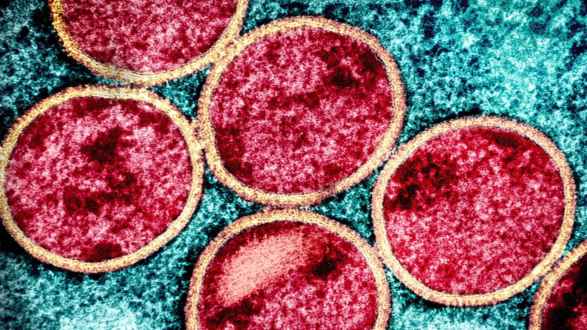 Eingefärbtes Transmissionselektronenmikroskop-Bild unreifer Mpox-Viruspartikel (rot mit hellbrauner Virushülle) in einer infizierten VERO-E6-Zelle (türkis), die im Labor kultiviert wurde.