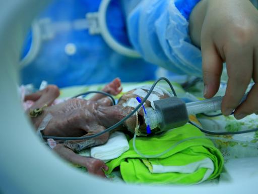 Eine Krankenschwester kümmert sich um ein Frühchen in einem Inkubator im "Affiliated Hospital of Hubei Institute for Nationalities" in Enshi, China