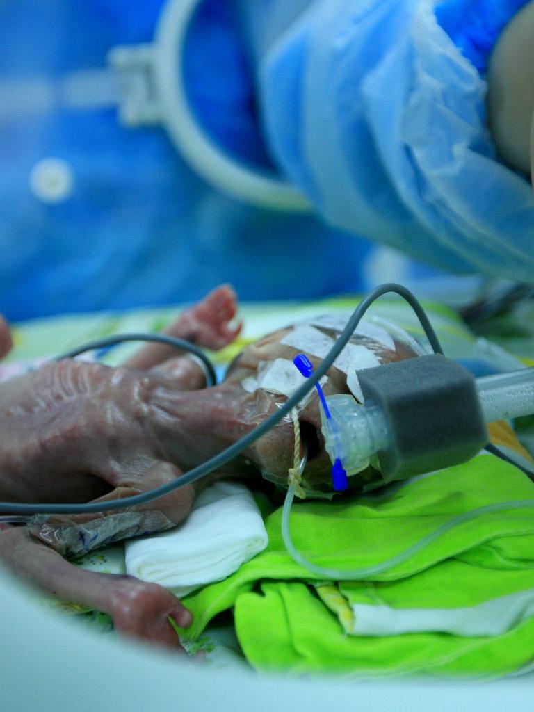 Eine Krankenschwester kümmert sich um ein Frühchen in einem Inkubator im "Affiliated Hospital of Hubei Institute for Nationalities" in Enshi, China