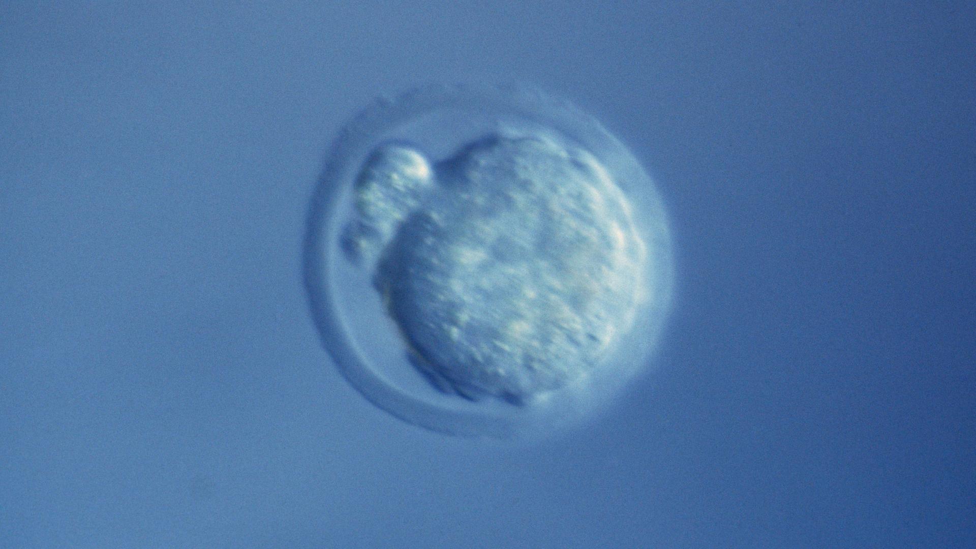 Tiefgefrorener Mäuse-Embryo in einer Petrischale. Tiefgefrorener Mäuse-Embryo in einer Petrischale.