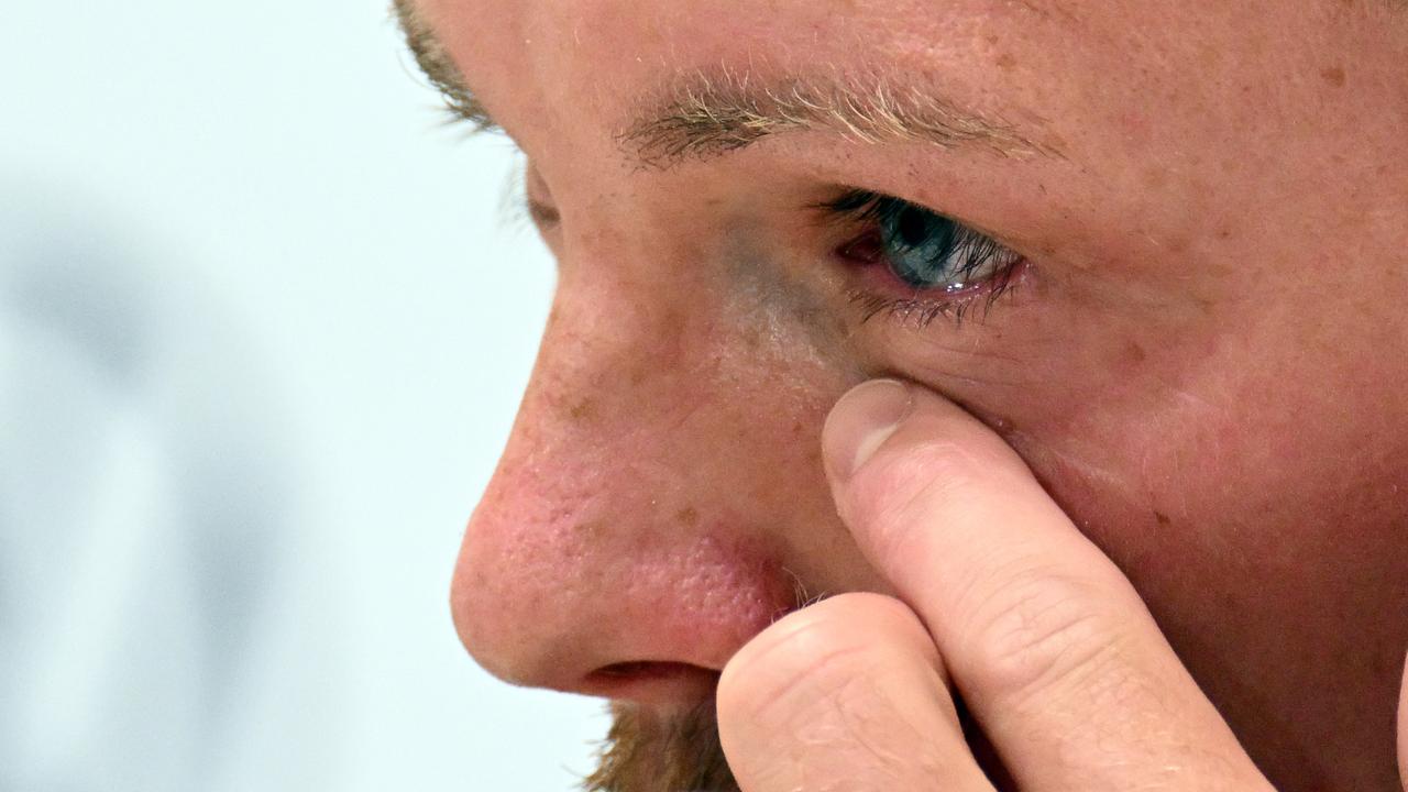 Bundestrainer Julian Nagelsmann kämpft während der Pressekonferenz mit den Tränen. 