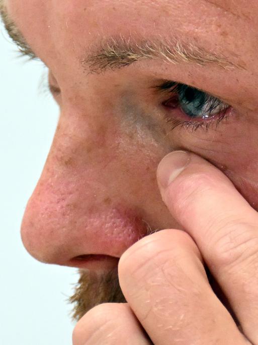 Bundestrainer Julian Nagelsmann kämpft während der Pressekonferenz mit den Tränen. 