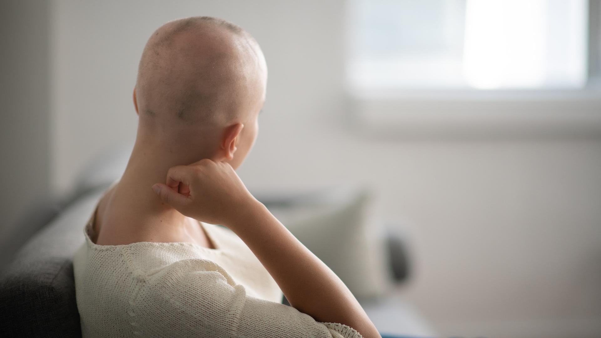 Eine Person mit Glatze aufgrund einer Chemotherapie guckt von der Kamera weg. Der Hintergrund ist hell gehalten.