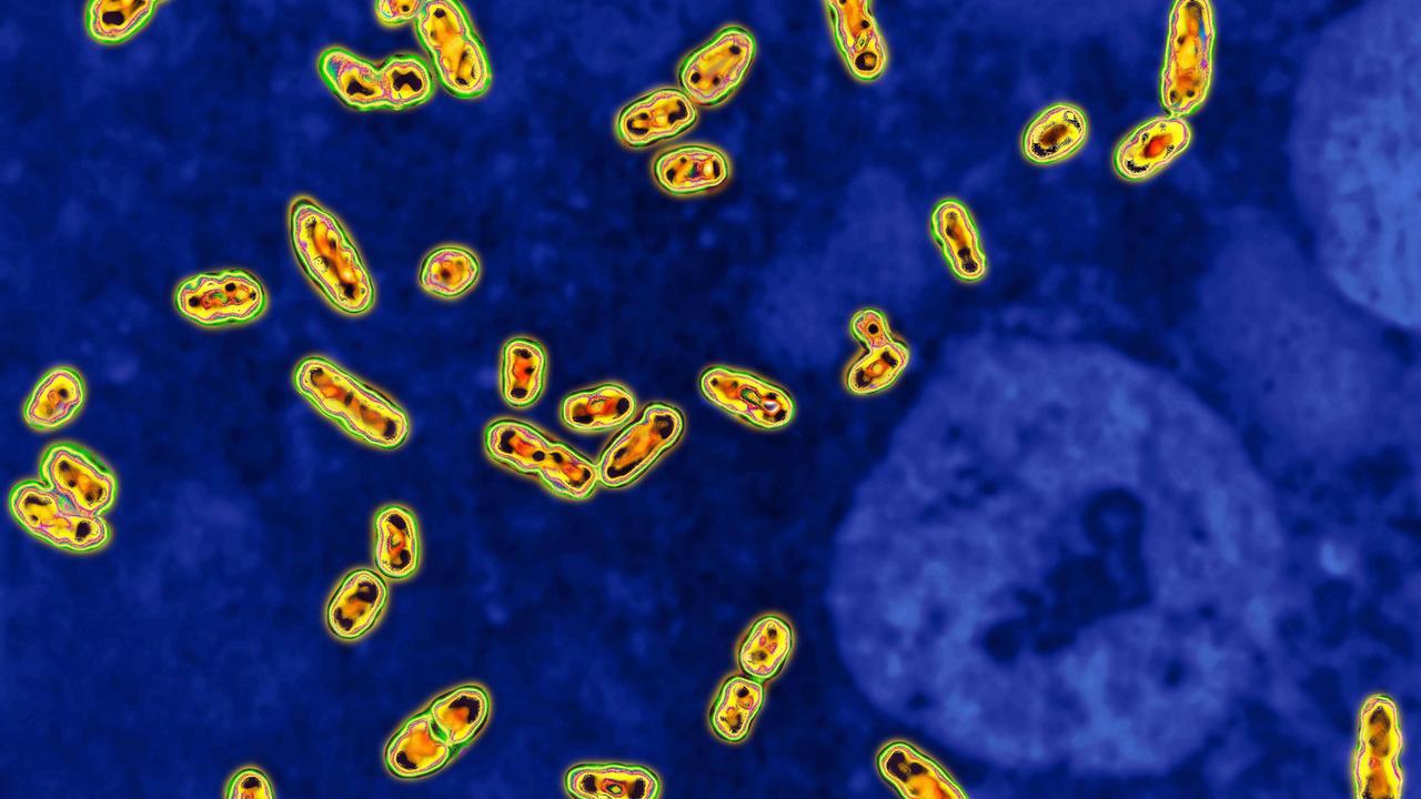 Das Bakterium Yersinia pestis unter dem Mikroskop in 2000-facher Vergrößerung. Es löst die Beulenpest aus.