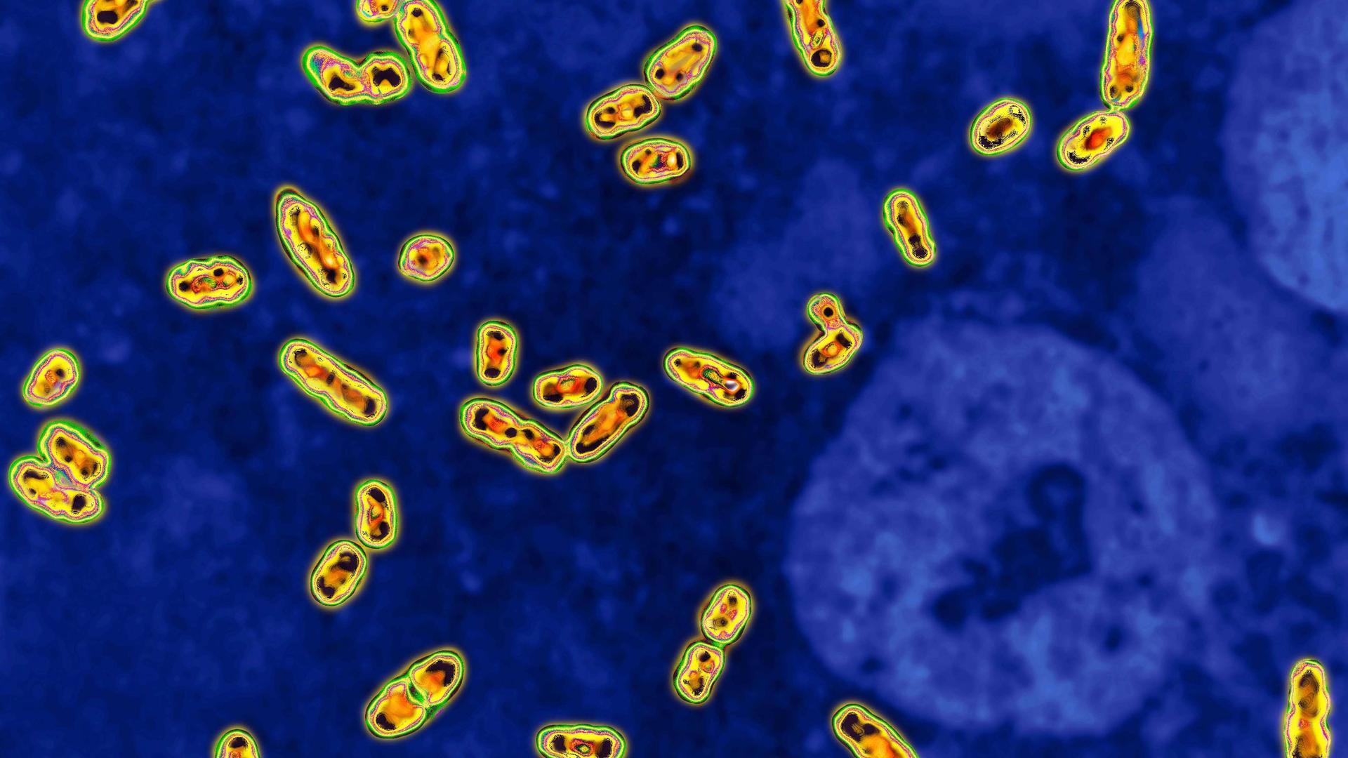 Das Bakterium Yersinia pestis unter dem Mikroskop in 2000-facher Vergrößerung. Es löst die Beulenpest aus.
