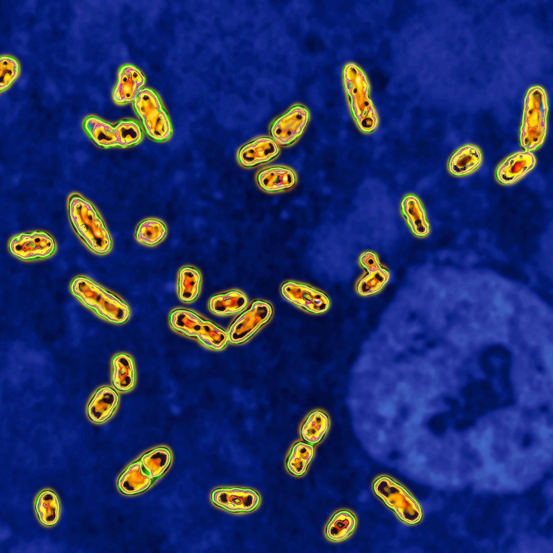 Das Bakterium Yersinia pestis unter dem Mikroskop in 2000-facher Vergrößerung. Es löst die Beulenpest aus.