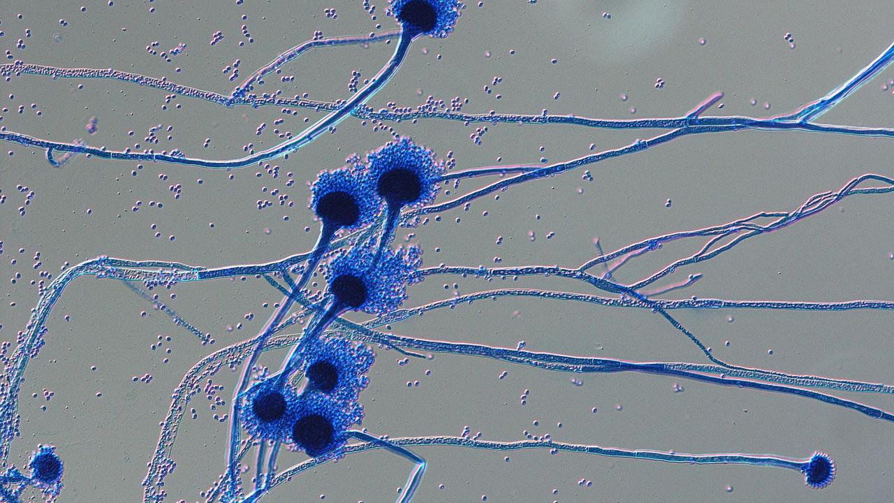 Mikroskopische Aufnahme von Sporenträgern des humanpathogenen Pilzes Aspergillus fumigatus
