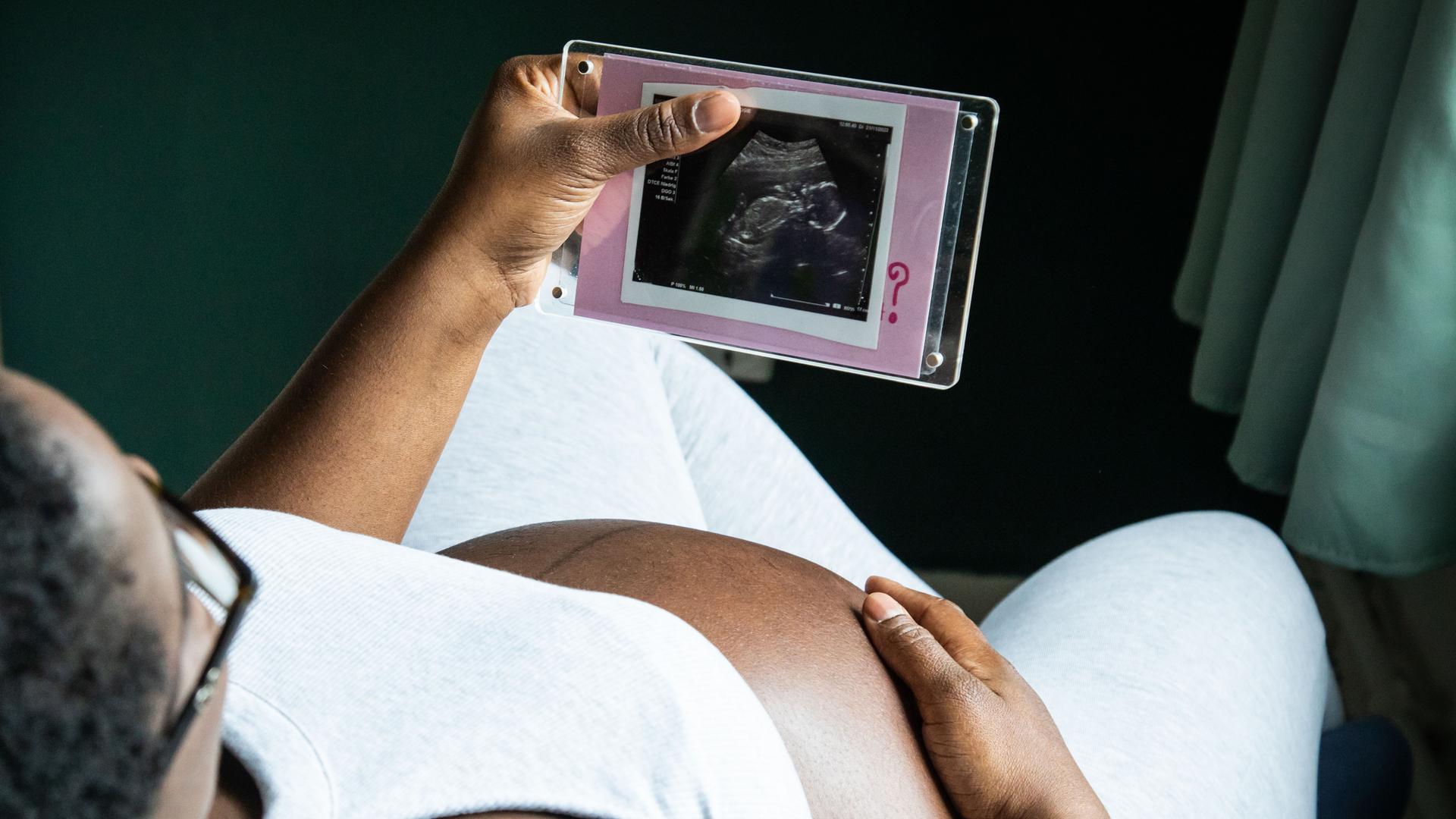 ILLUSTRATION - Eine im 9. Monat schwangere Frau sitzt am 26.03.2024 in Berlin entspannt auf einem Sessel und schaut auf das Ultraschallbild ihres Babys (gestellte Szene). ILLUSTRATION - Eine im 9. Monat schwangere Frau sitzt am 26.03.2024 in Berlin entspannt auf einem Sessel und schaut auf das Ultraschallbild ihres Babys (gestellte Szene).